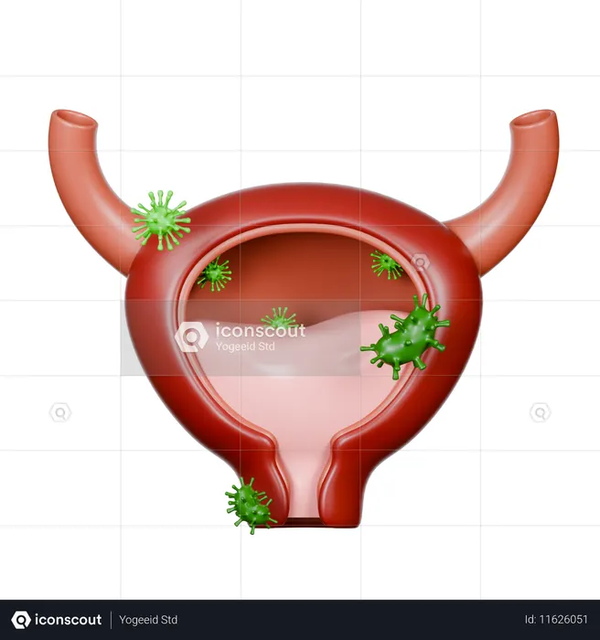 Bladder Diseases  3D Icon
