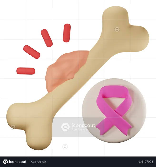 Bone cancer  3D Icon
