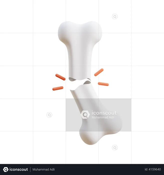 Bone Fracture  3D Illustration