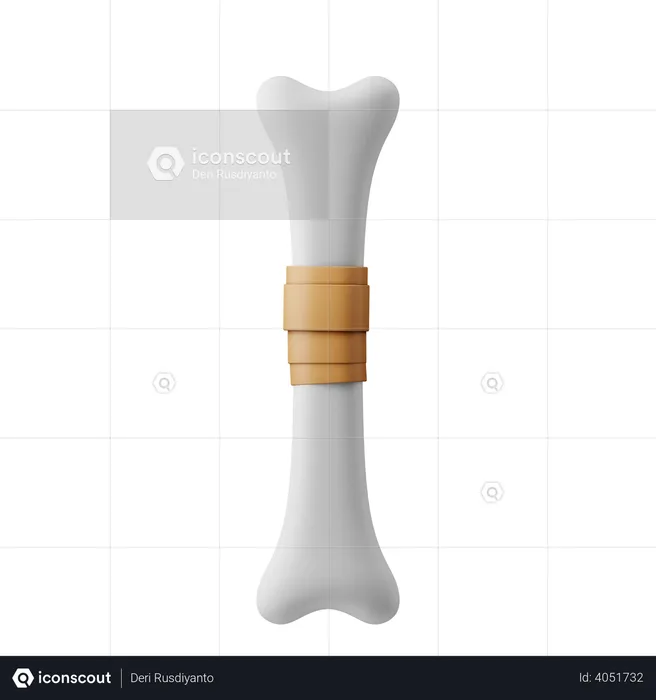 Bone Fracture Recovery  3D Illustration