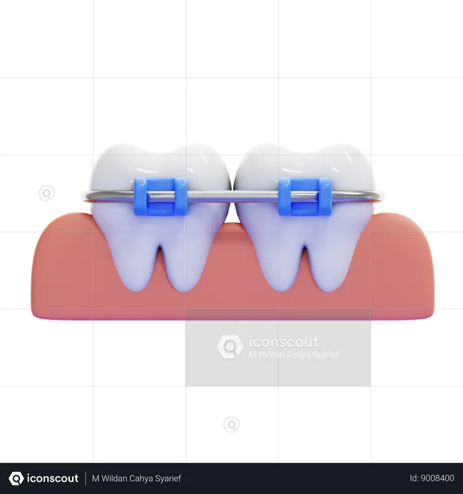 BRACES  3D Icon