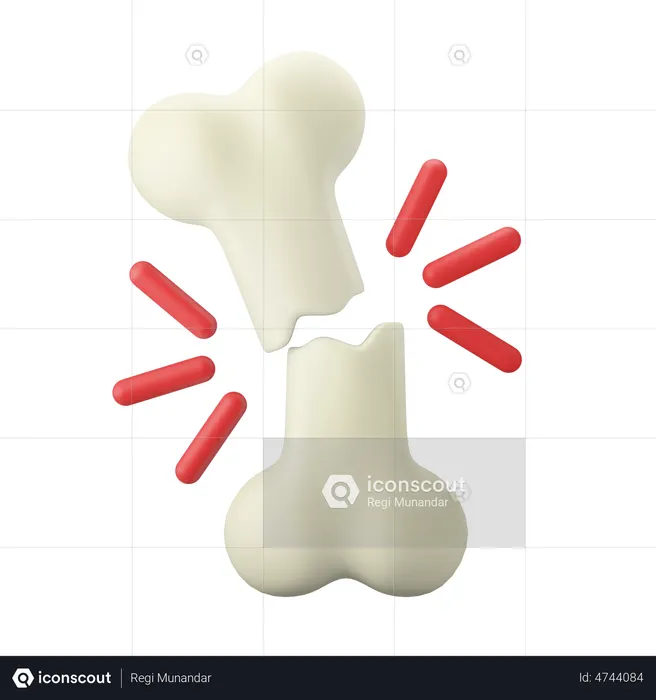 Broken Bone  3D Illustration