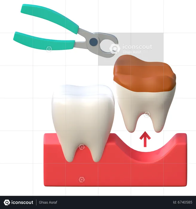 Broken Tooth Extraction  3D Icon