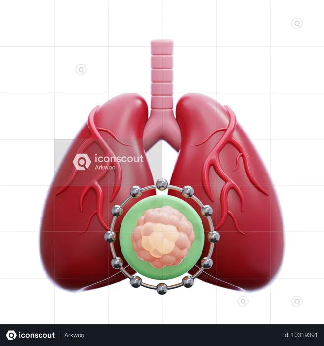 Cáncer de pulmón  3D Icon