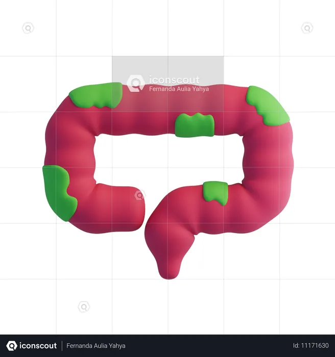 Cancer du colon  3D Icon