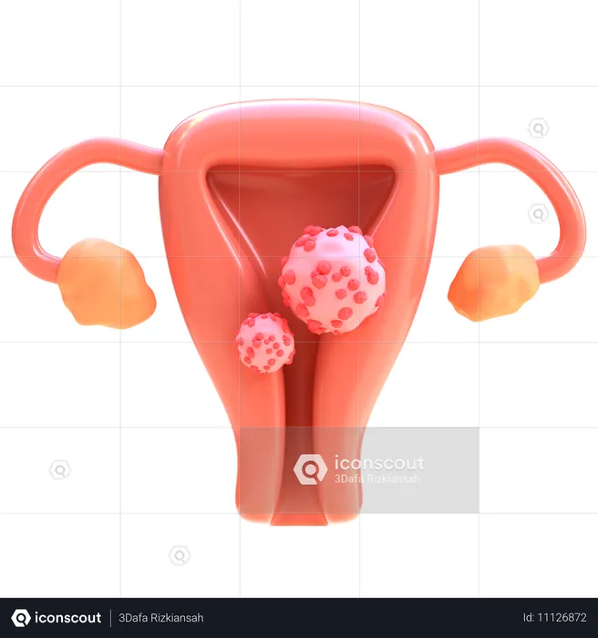 Cervical Cancer  3D Icon