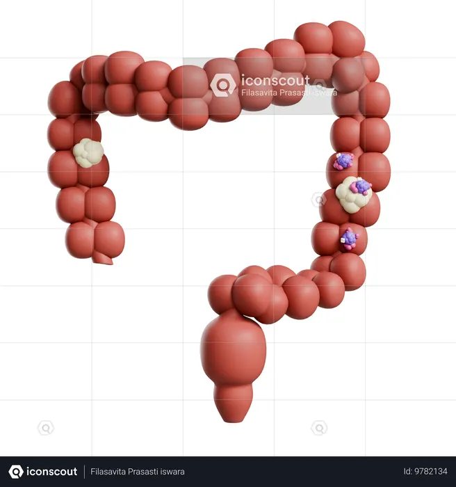 Colon Cancer  3D Icon