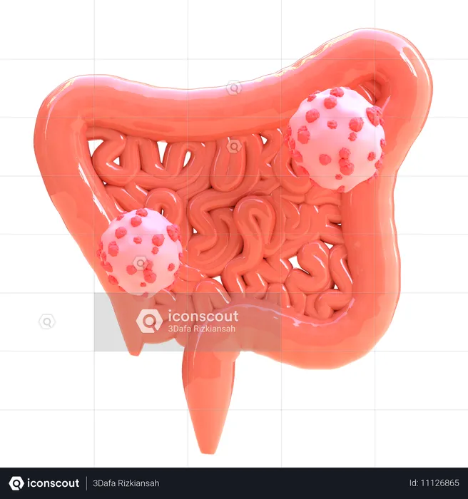 大腸がん  3D Icon