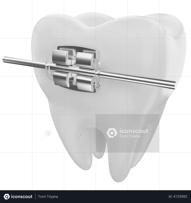Dental braces  3D Illustration