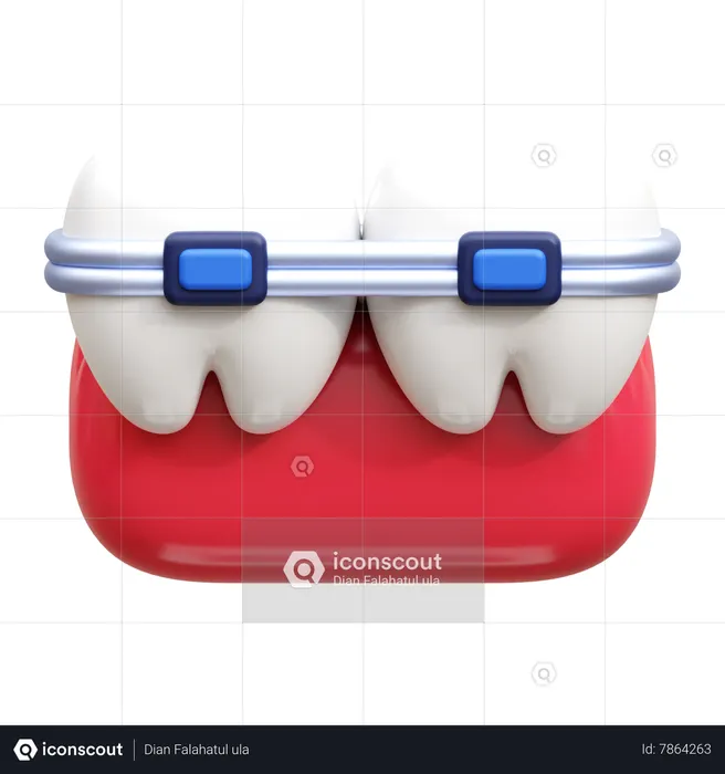 Dental Braces  3D Icon