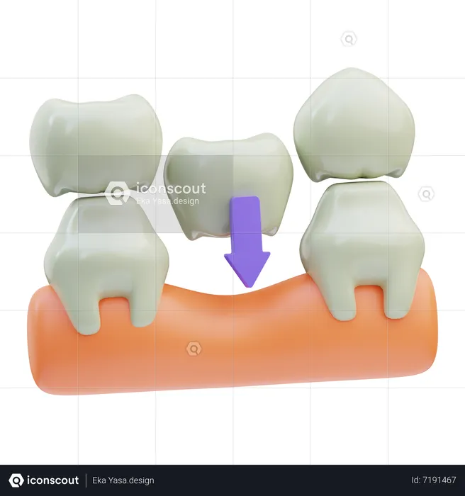 Dental Bridge  3D Icon