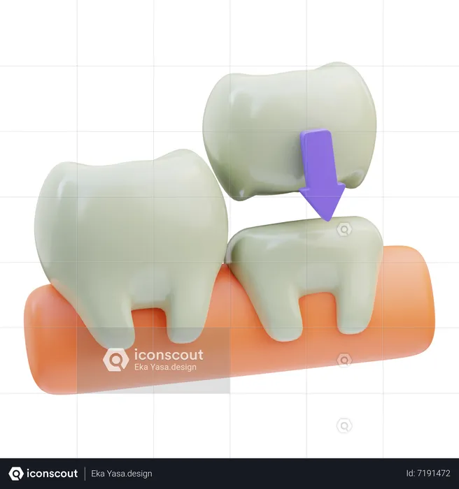 Dental Crown  3D Icon