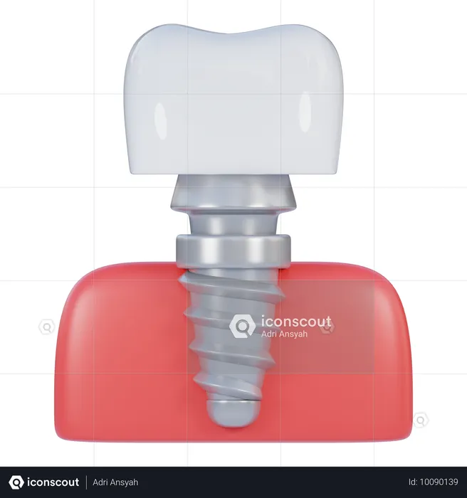 Dental implant  3D Icon