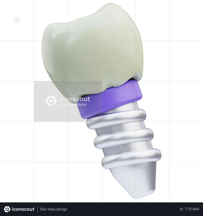 Dental Implant  3D Icon