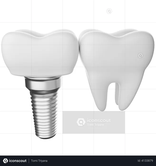 Dental implant  3D Illustration