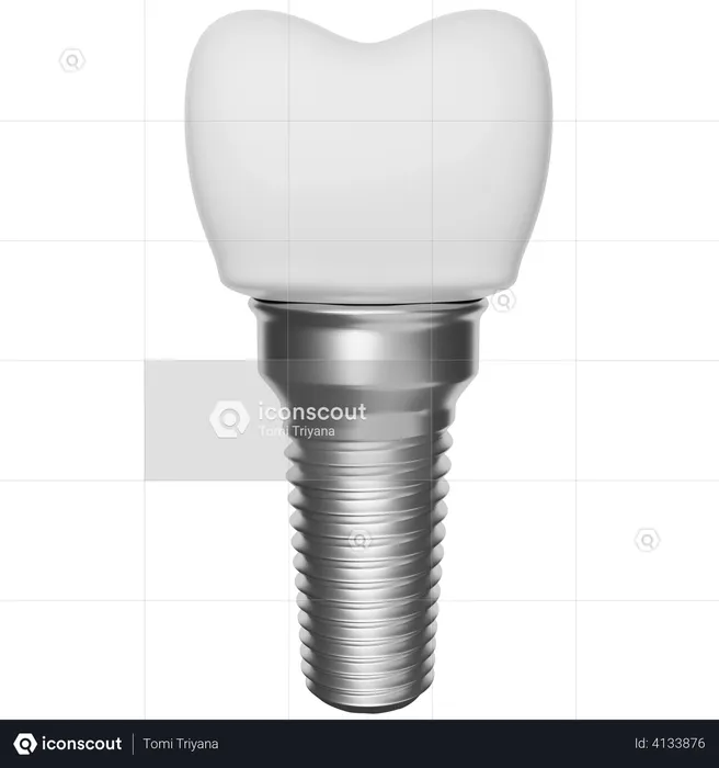 Dental implant  3D Illustration