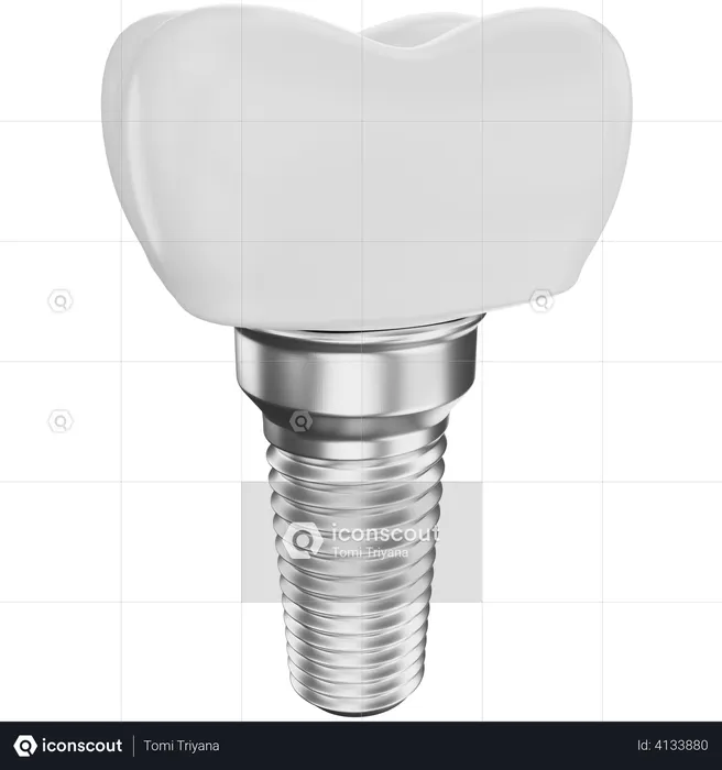 Dental implant  3D Illustration