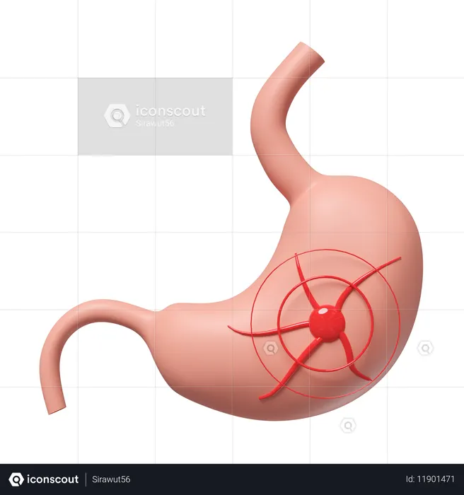 Enfermedad gástrica  3D Icon