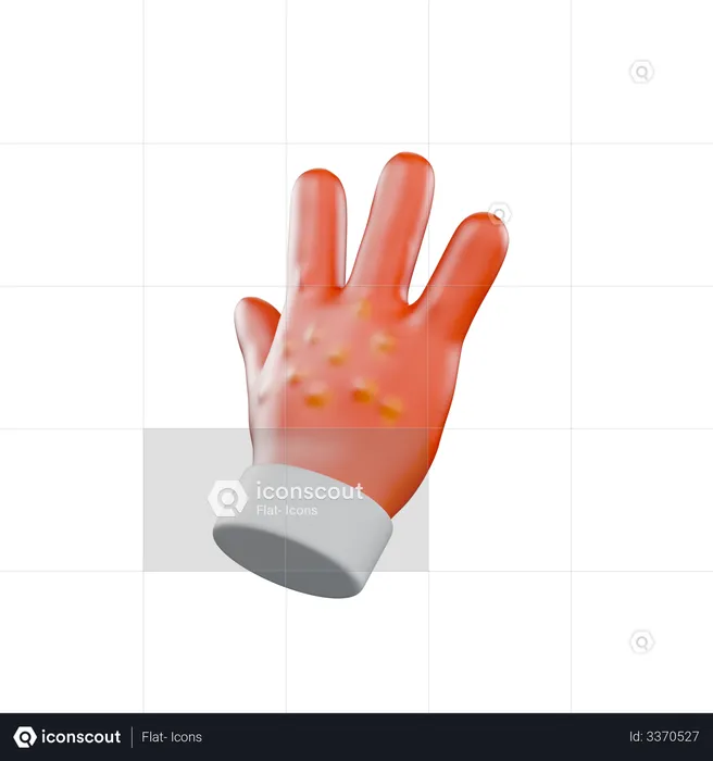 Hand Allergy  3D Illustration