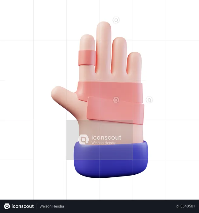 Hand Injury  3D Illustration