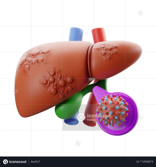 Hepatitis with virus icon.  3D Icon