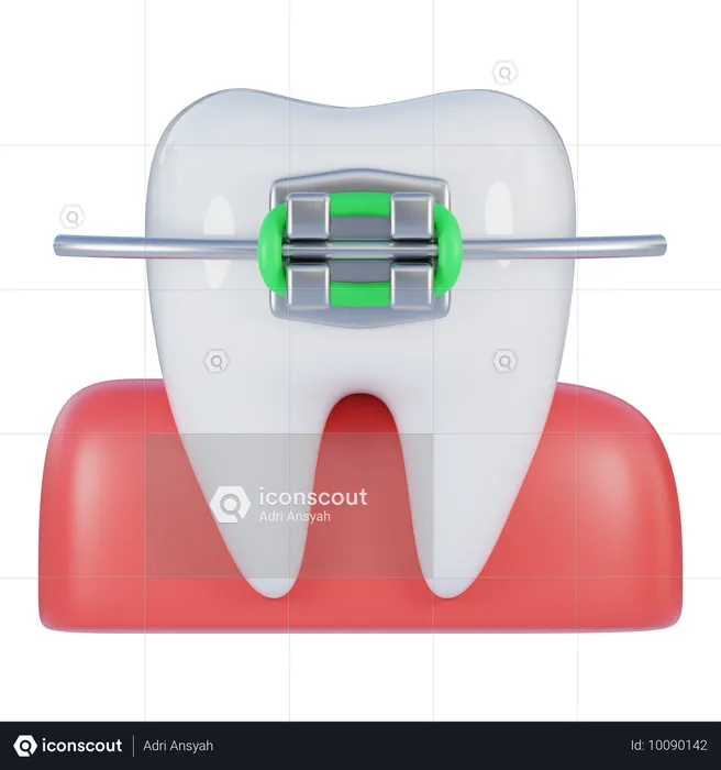 Zahnspange  3D Icon