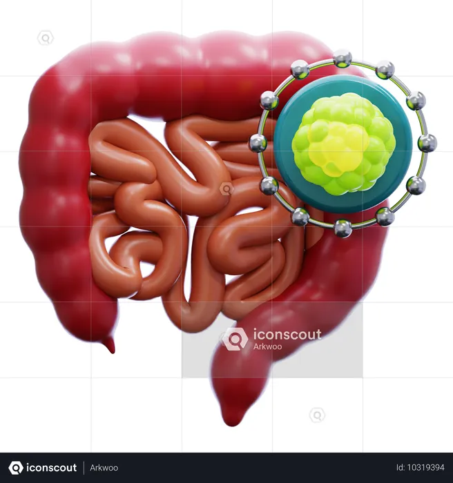 Intestine Cancer  3D Icon