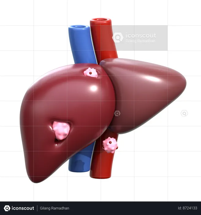 Liver Cancer  3D Icon