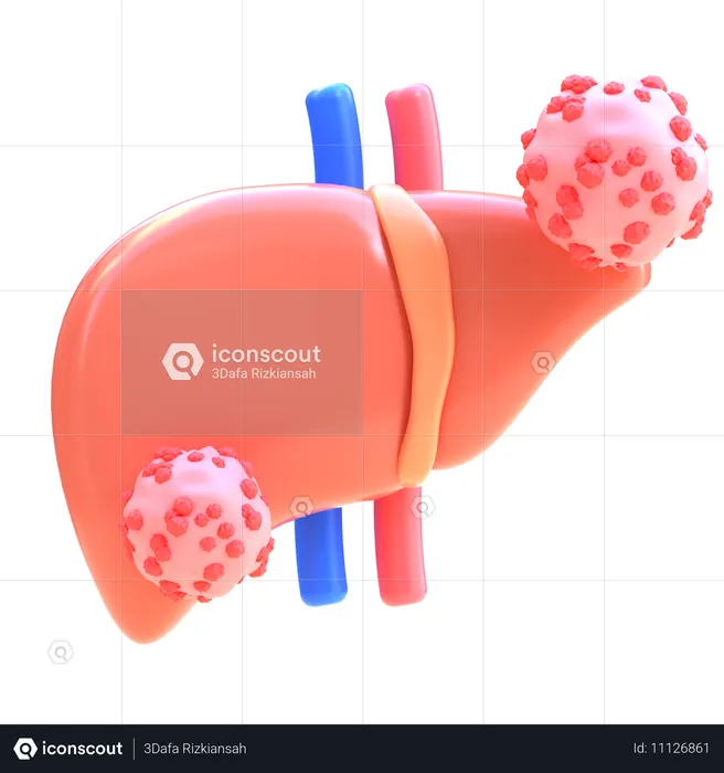 Liver Cancer  3D Icon