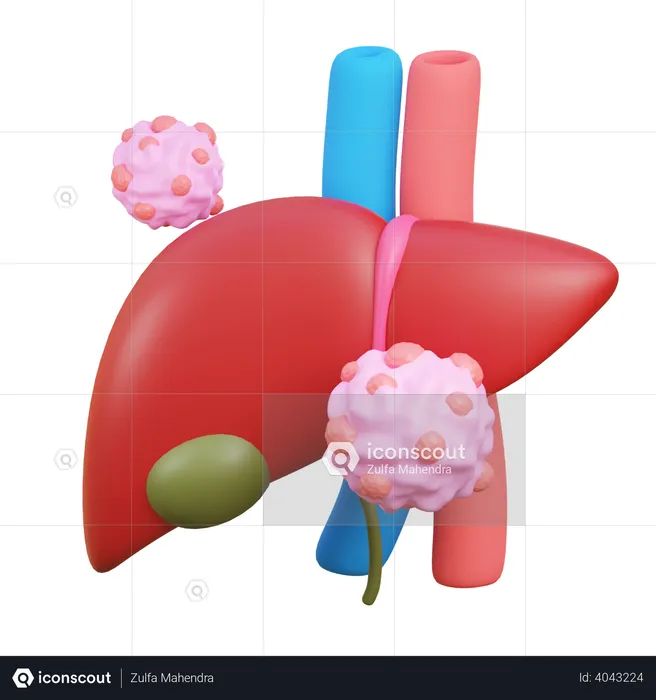 Liver cancer  3D Icon