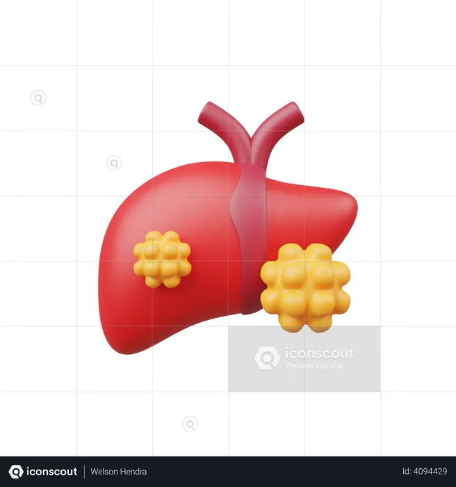 Liver Cancer  3D Illustration