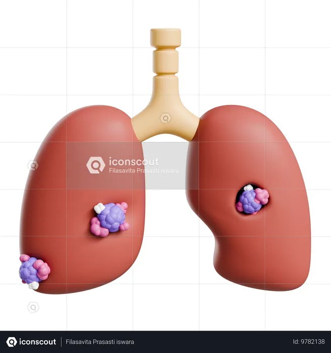 Lung Cancer  3D Icon