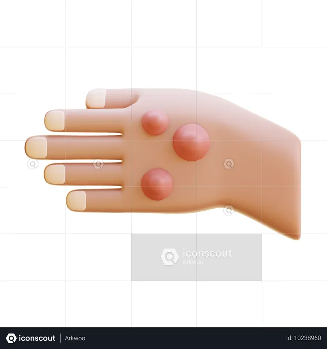 Rheumatoid Nodule  3D Icon