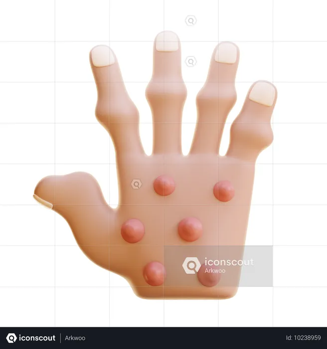 Rheumatoid Nodules  3D Icon