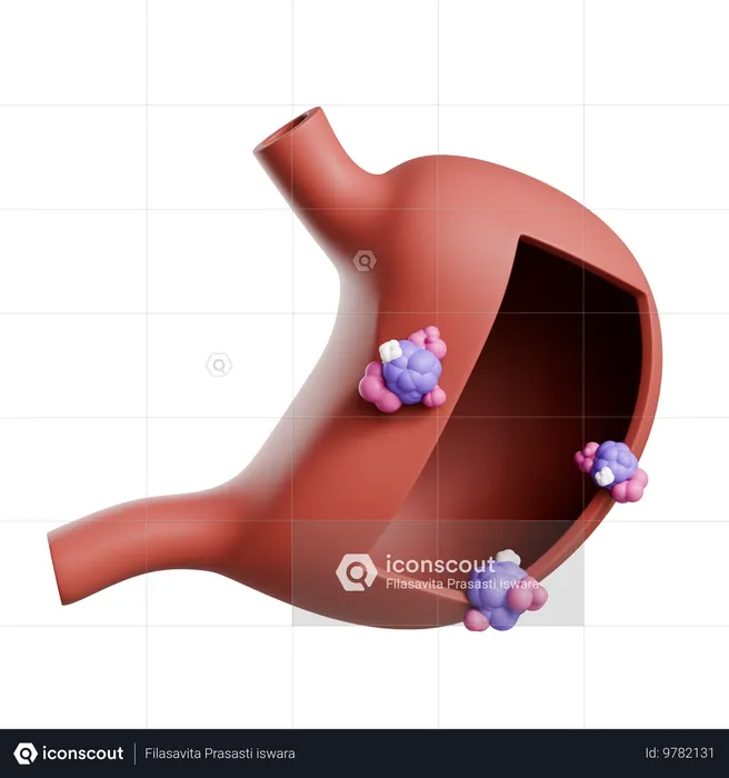 Stomach Cancer  3D Icon