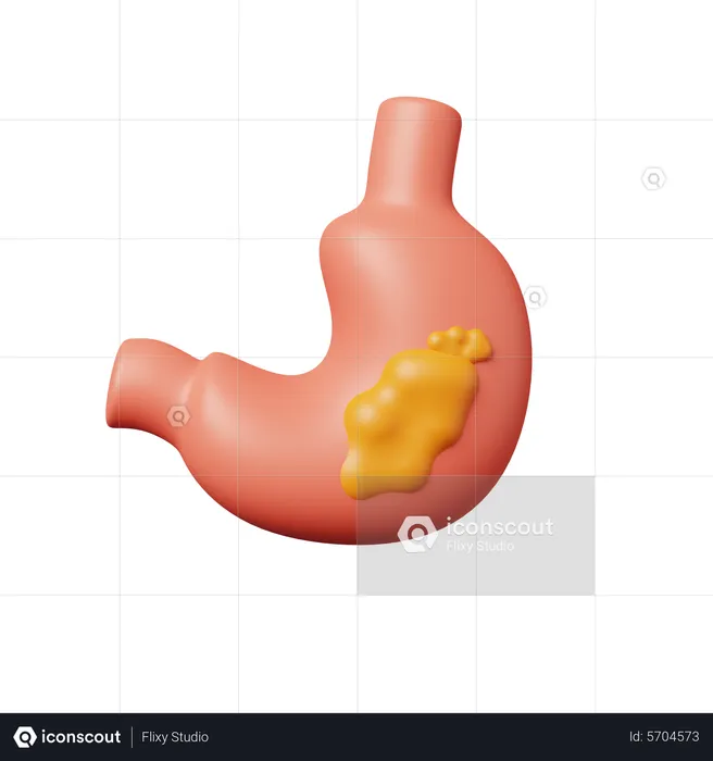 Stomach Cancer  3D Icon