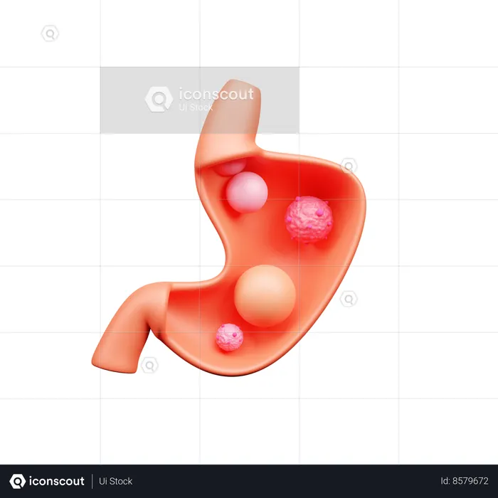 Stomotch Cancer  3D Icon