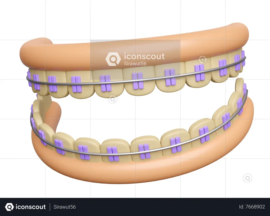 Teeth braces with gum  3D Illustration