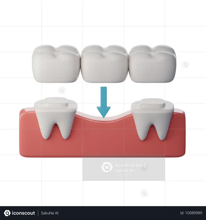 치아 브릿지  3D Icon