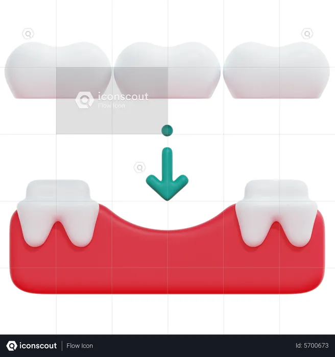 Teeth Bridge  3D Icon