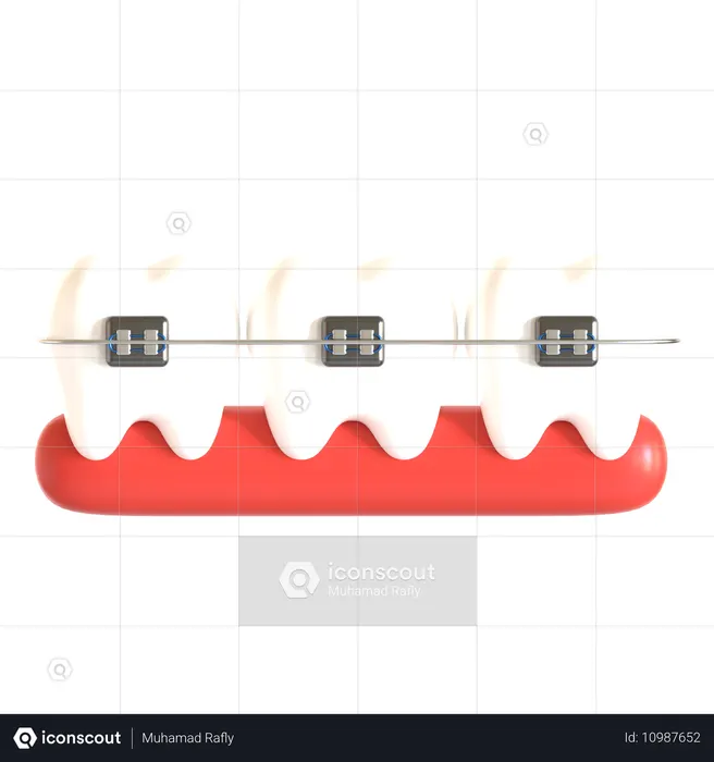 Tooth Braces  3D Icon