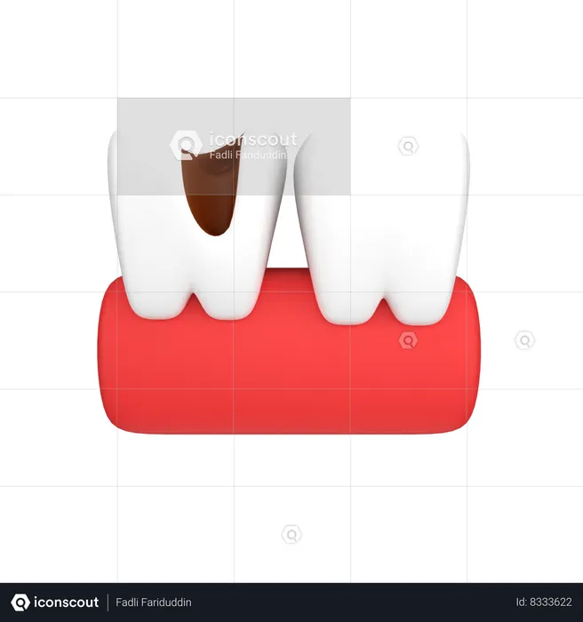 Tooth Cavity  3D Icon