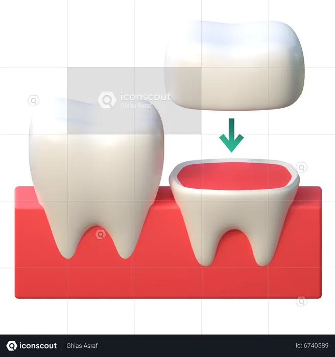 Tooth Crown Implant  3D Icon