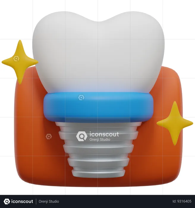 Tooth Implant  3D Icon