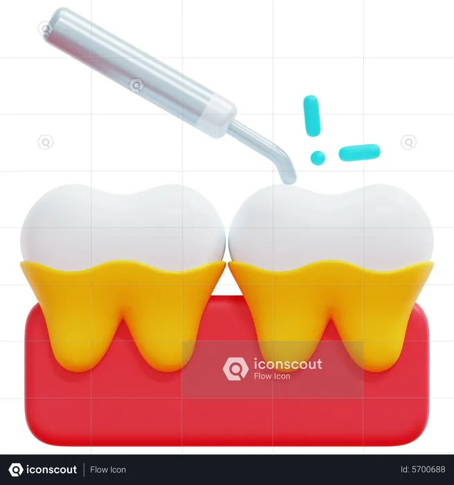 Tratamiento de raspado dental  3D Icon