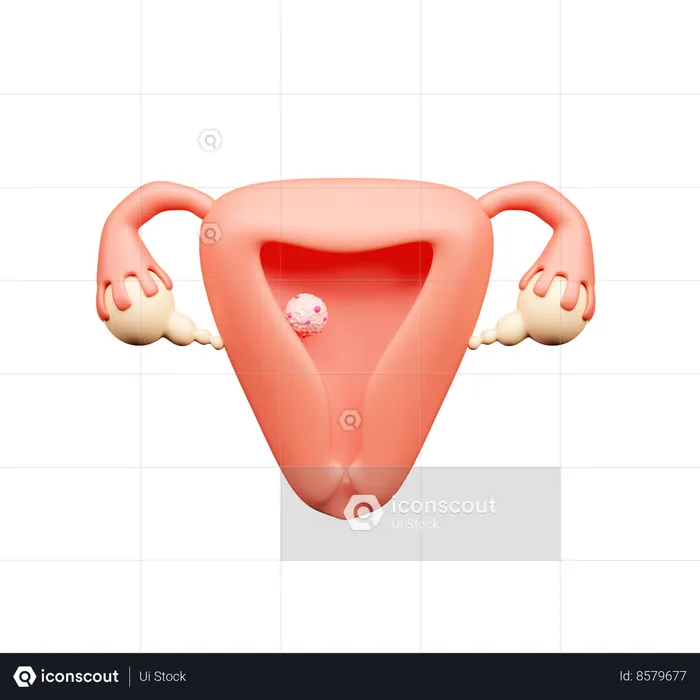 Uterus Cancer  3D Icon