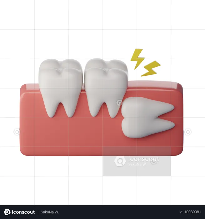 Wisdom Tooth Horizontal  3D Icon