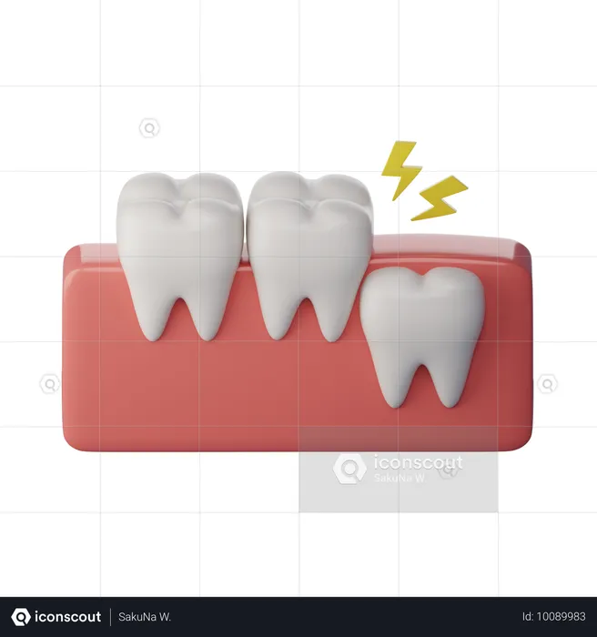 Wisdom Tooth Vertical  3D Icon