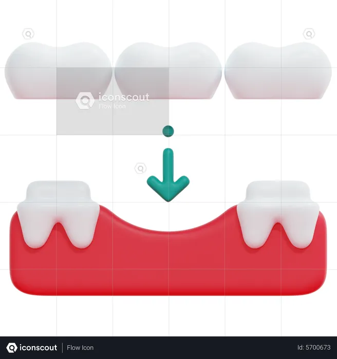 Zahnbrücke  3D Icon