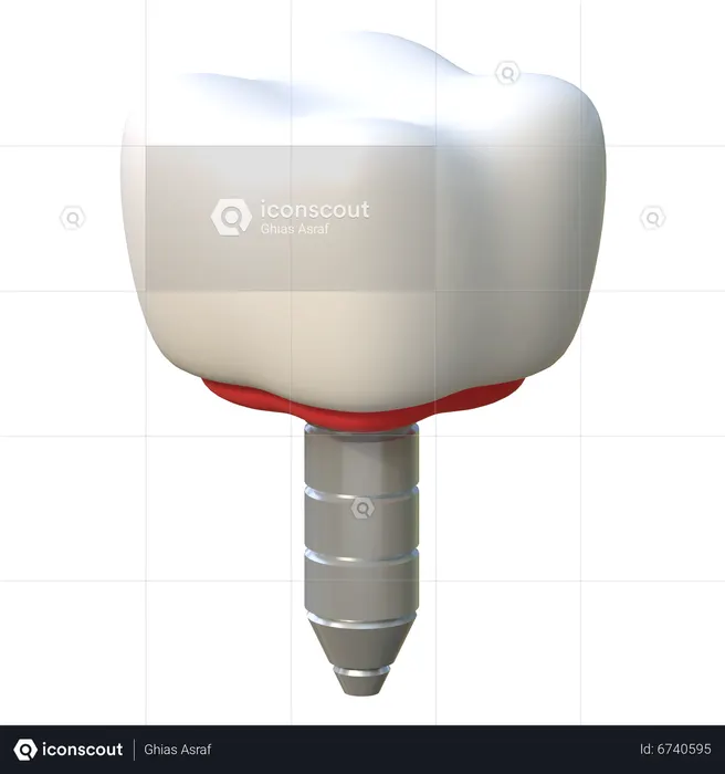 Zahnimplantat  3D Icon
